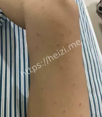 黑子网