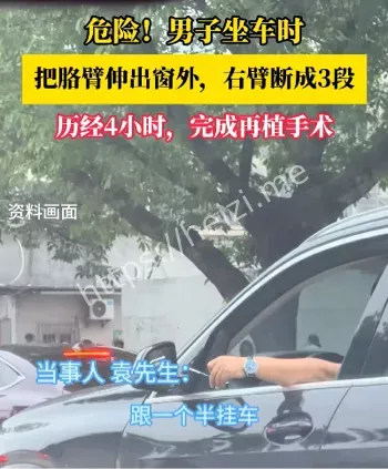 男子胳膊断3截