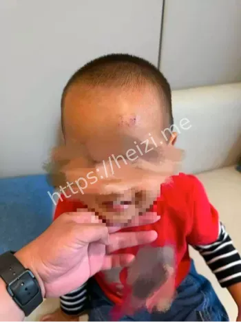 男童坠落栈道