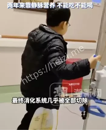 儿童医疗安全多器官切除案例