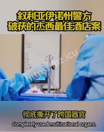 杰西最佳酒店器官案